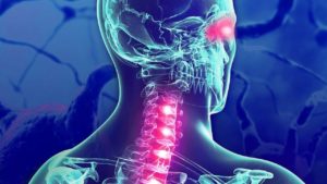 What Cause Multiple Sclerosis 300x169 - 10 Little Known Uses for CBD